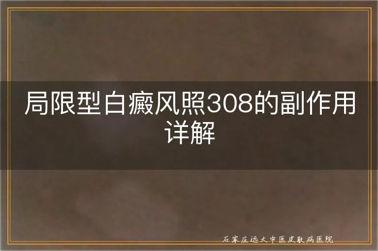 局限型白癜风照308的副作用详解