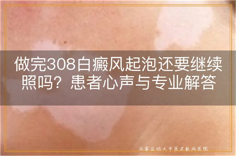 做完308白癜风起泡还要继续照吗？患者心声与专业解答