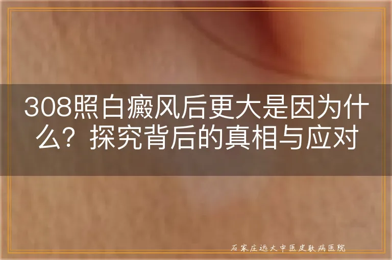 308照白癜风后更大是因为什么？探究背后的真相与应对策略