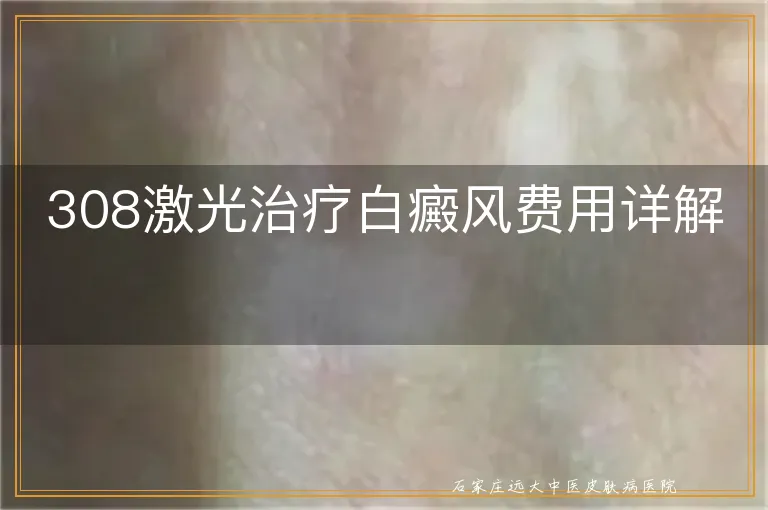 308激光治疗白癜风费用详解