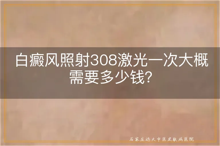 白癜风照射308激光一次大概需要多少钱？