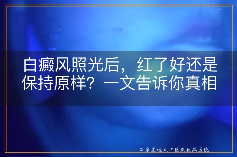 白癜风照光后，红了好还是保持原样？一文告诉你真相！