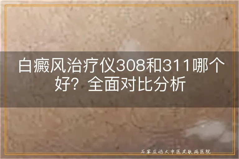 白癜风治疗仪308和311哪个好？全面对比分析