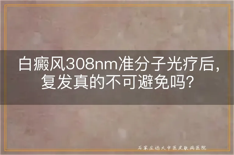 白癜风308nm准分子光疗后，复发真的不可避免吗？