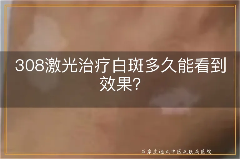 308激光治疗白斑多久能看到效果？