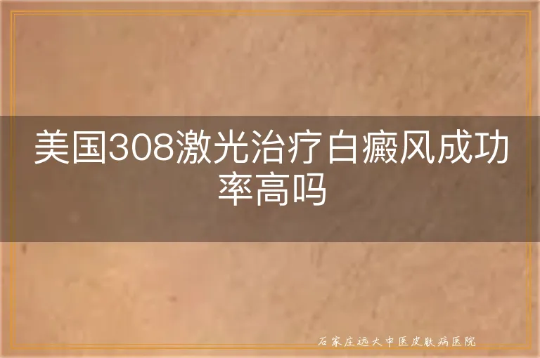 美国308激光治疗白癜风成功率高吗