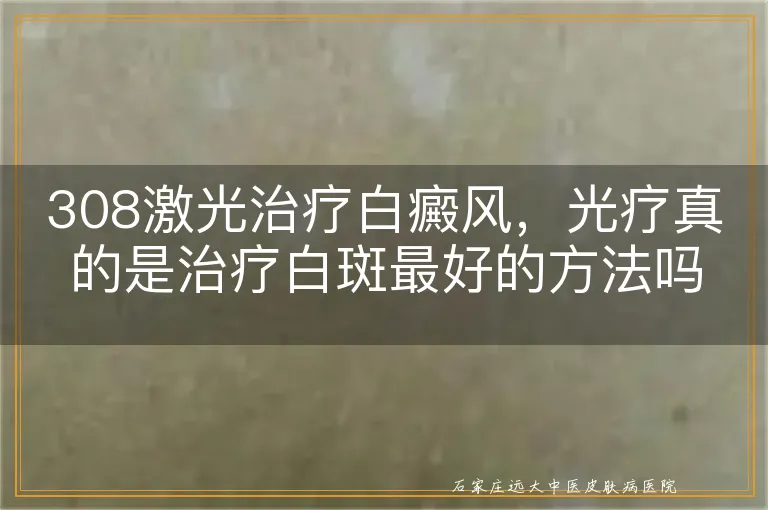 308激光治疗白癜风，光疗真的是治疗白斑最好的方法吗？