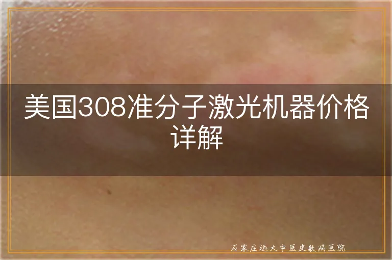 美国308准分子激光机器价格详解