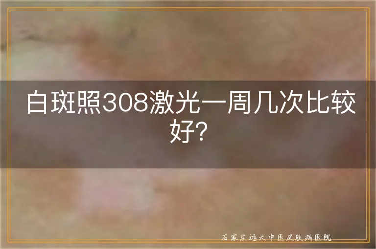 白斑照308激光一周几次比较好？