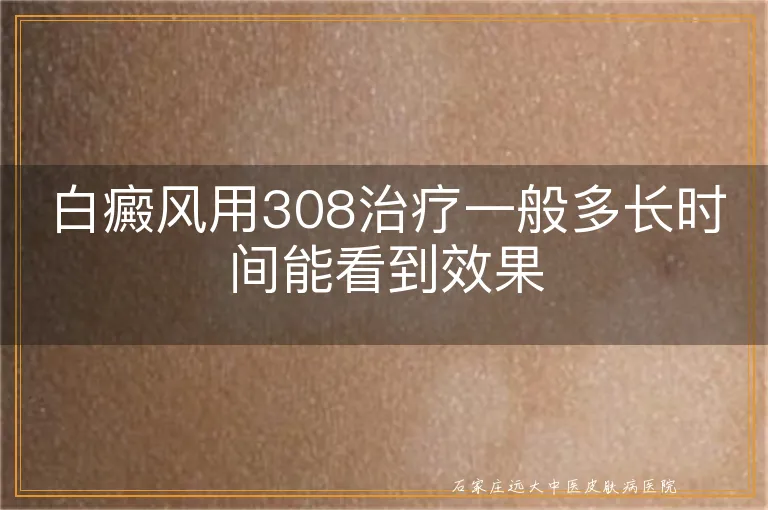 白癜风用308治疗一般多长时间能看到效果