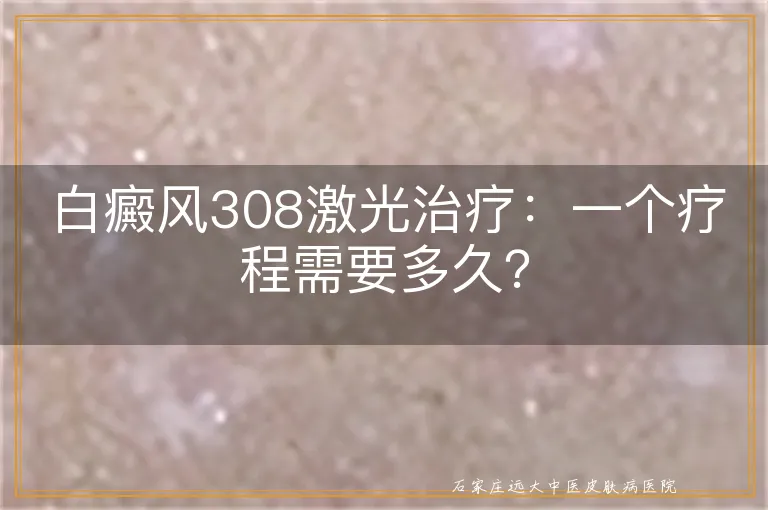 白癜风308激光治疗：一个疗程需要多久？