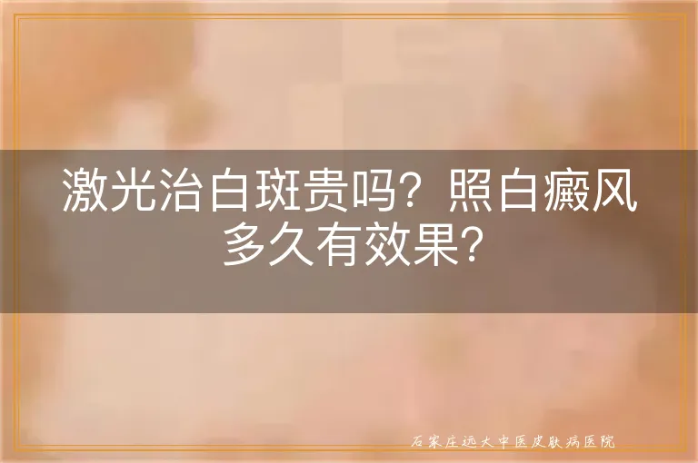 激光治白斑贵吗？照白癜风多久有效果？