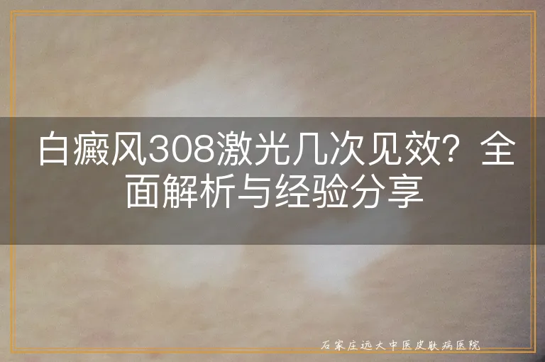 白癜风308激光几次见效？全面解析与经验分享