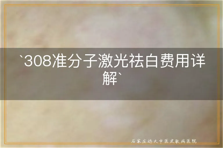 308准分子激光祛白费用详解