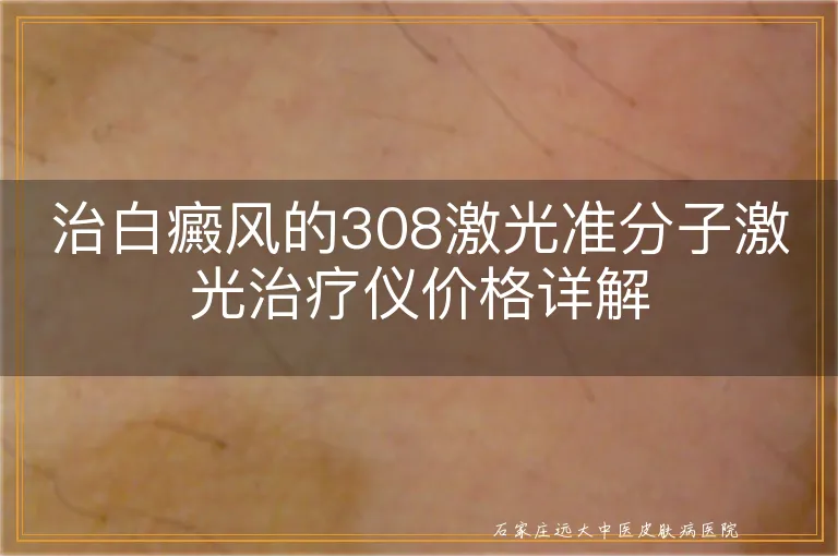 治白癜风的308激光准分子激光治疗仪价格详解