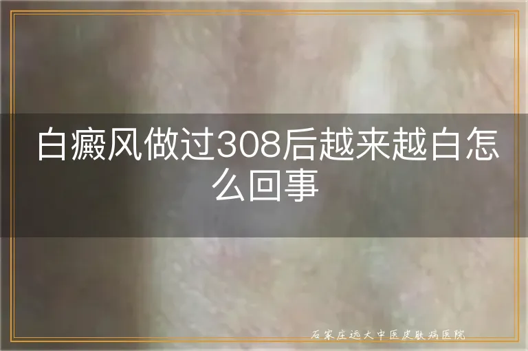 白癜风做过308后越来越白怎么回事