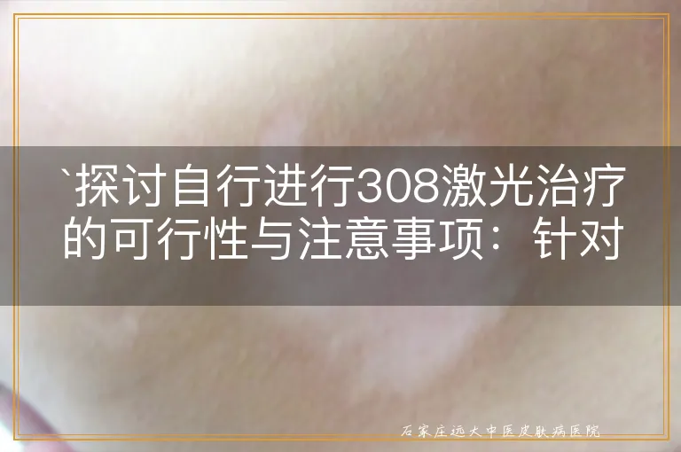 探讨自行进行308激光治疗的可行性与注意事项：针对白癜风及白斑患者的专业分析