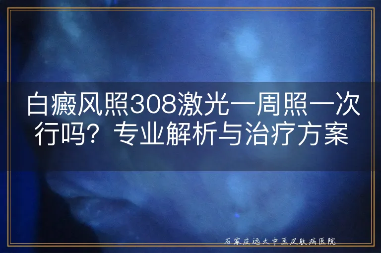 白癜风照308激光一周照一次行吗？专业解析与治疗方案探讨