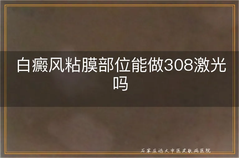 白癜风粘膜部位能做308激光吗