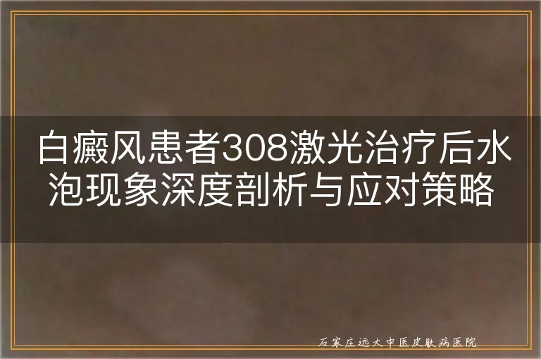 白癜风患者308激光治疗后水泡现象深度剖析与应对策略