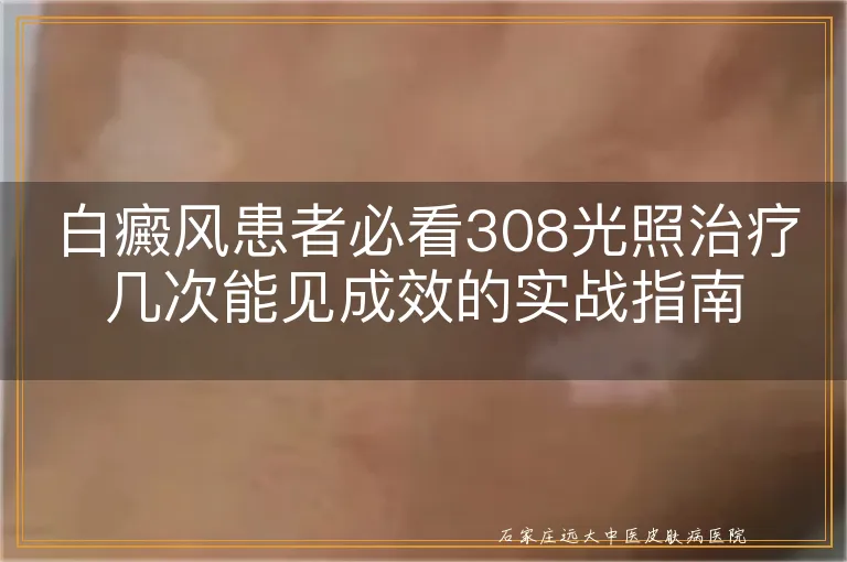 白癜风患者必看308光照治疗几次能见成效的实战指南