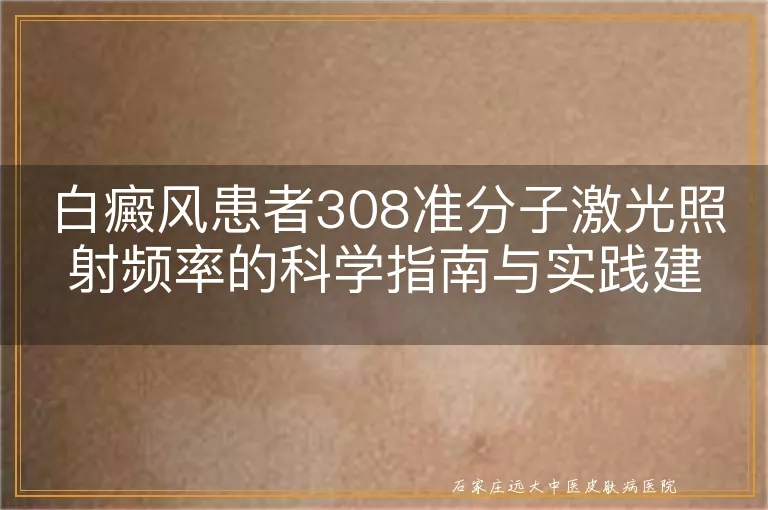 白癜风患者308准分子激光照射频率的科学指南与实践建议