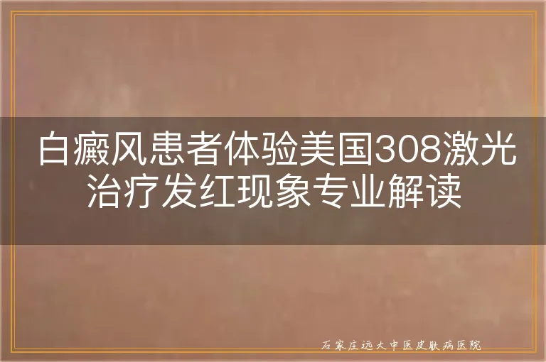 白癜风患者体验美国308激光治疗发红现象专业解读