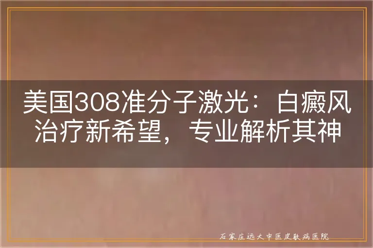 美国308准分子激光：白癜风治疗新希望，专业解析其神奇效果