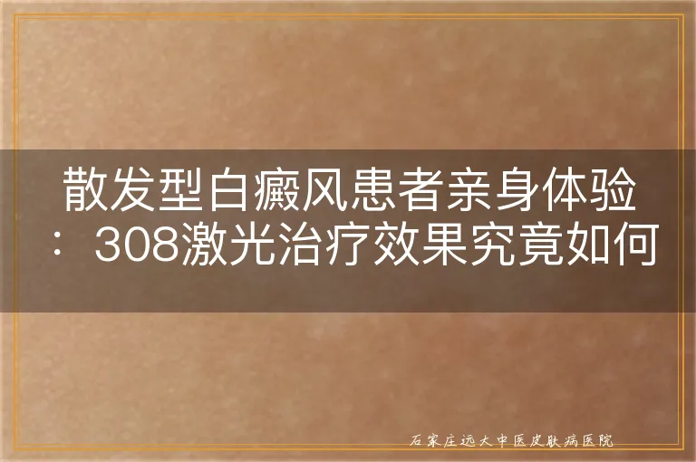 散发型白癜风患者亲身体验：308激光治疗效果究竟如何