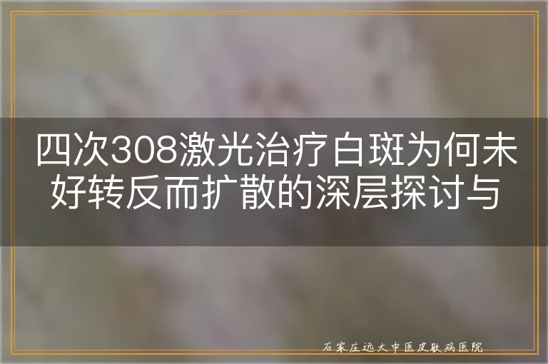 四次308激光治疗白斑为何未好转反而扩散的深层探讨与应对策略