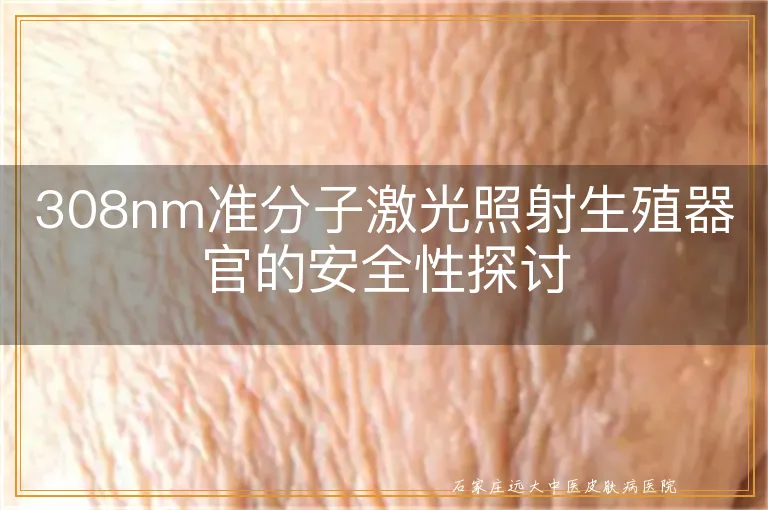 308nm准分子激光照射生殖器官的安全性探讨