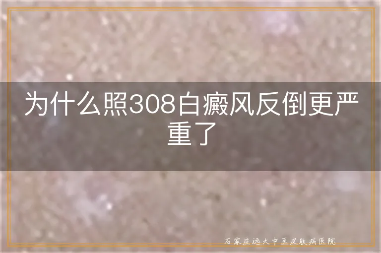 为什么照308白癜风反倒更严重了