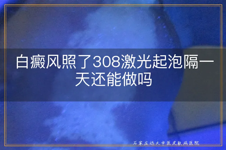 白癜风照了308激光起泡隔一天还能做吗