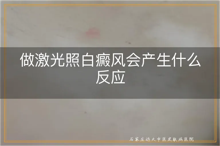 做激光照白癜风会产生什么反应