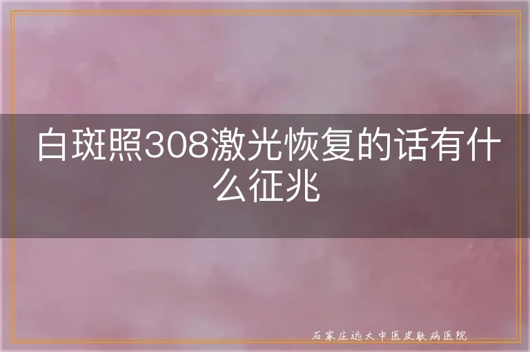 白斑照308激光恢复的话有什么征兆