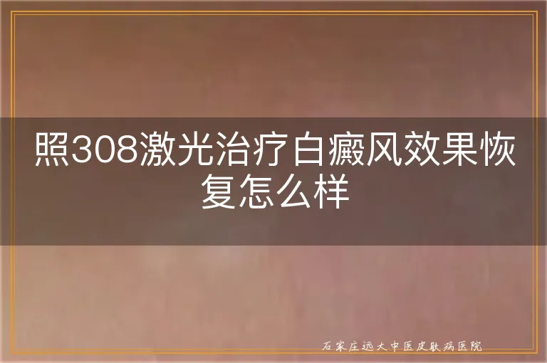 照308激光治疗白癜风效果恢复怎么样