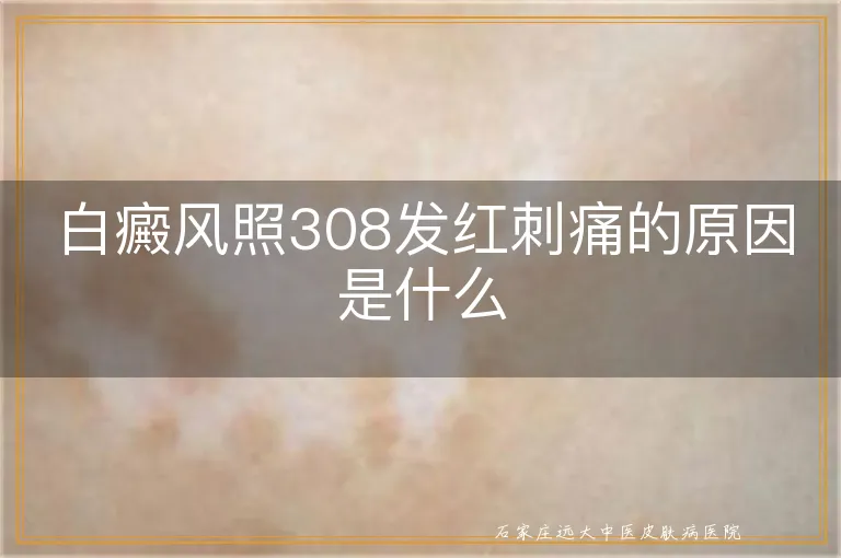 白癜风照308发红刺痛的原因是什么