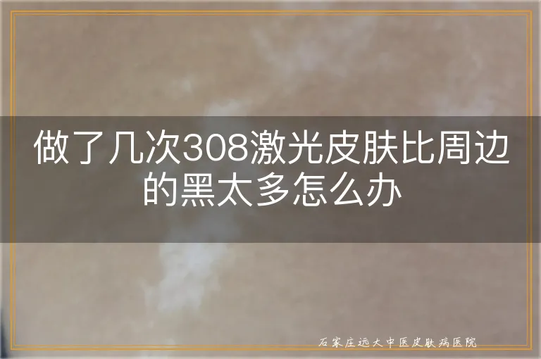 做了几次308激光皮肤比周边的黑太多怎么办