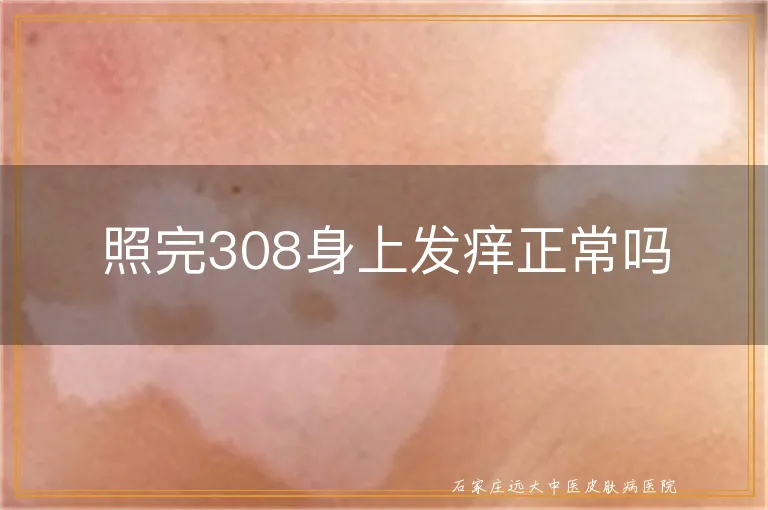 照完308身上发痒正常吗