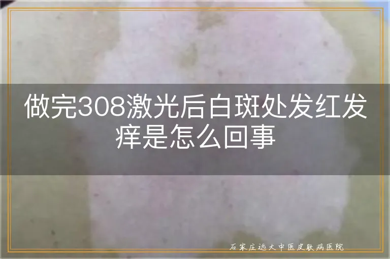 做完308激光后白斑处发红发痒是怎么回事