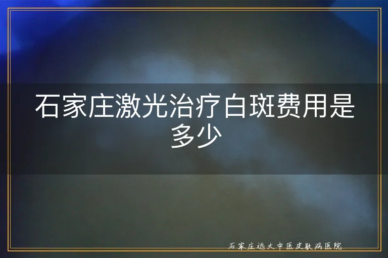 石家庄激光治疗白斑费用是多少