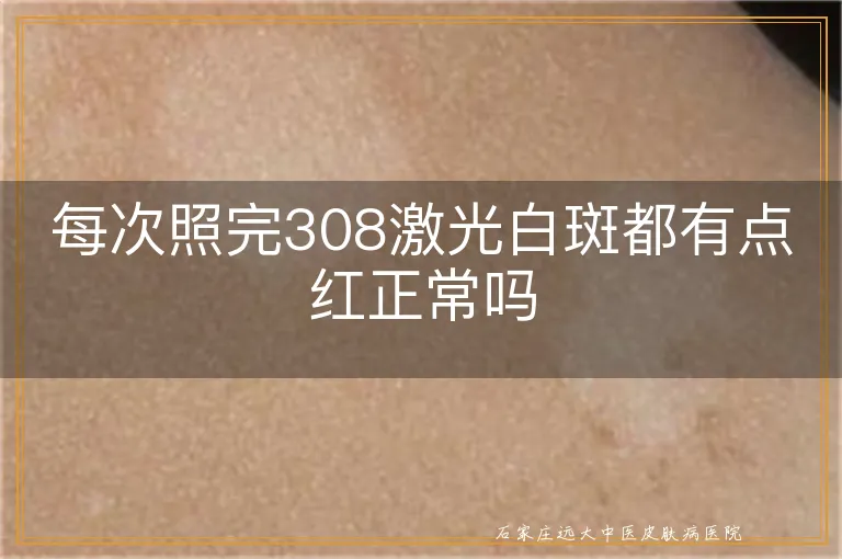 每次照完308激光白斑都有点红正常吗