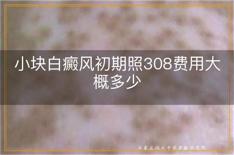 小块白癜风初期照308费用大概多少