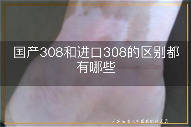 国产308和进口308的区别都有哪些