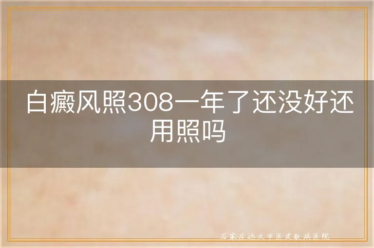 白癜风照308一年了还没好还用照吗