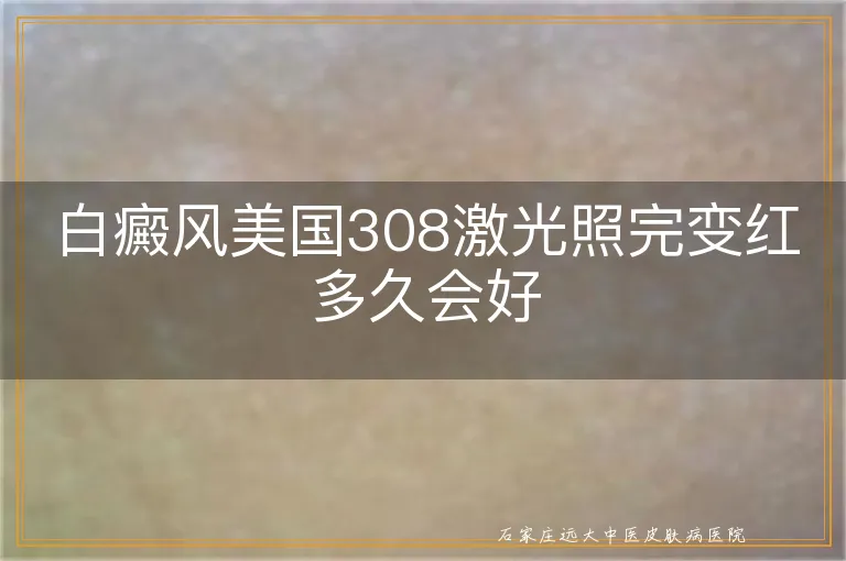 白癜风美国308激光照完变红多久会好