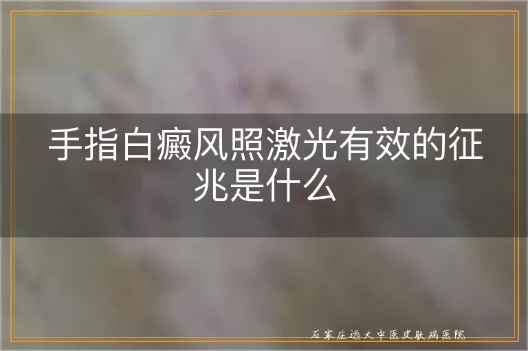 手指白癜风照激光有效的征兆是什么