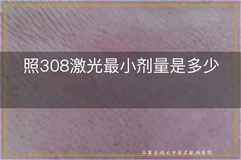 照308激光最小剂量是多少