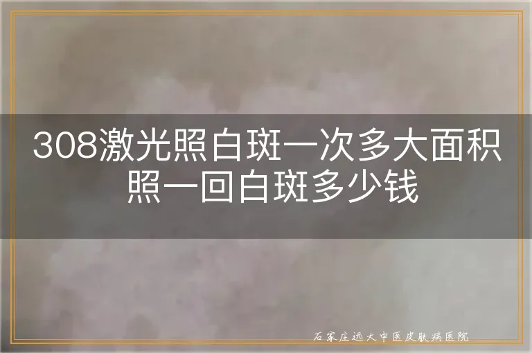 308激光照白斑一次多大面积 照一回白斑多少钱