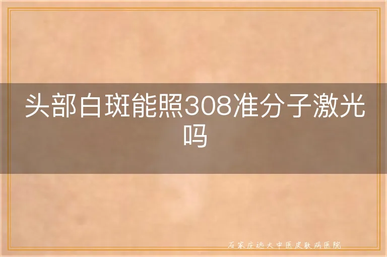 头部白斑能照308准分子激光吗